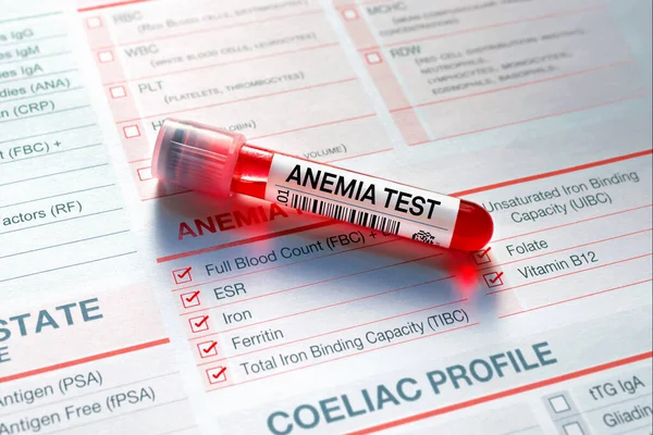 Teste Tubo Sanguíneo Com Formulário Requisição Para Teste Anemia Amostra — Fotografia de Stock
