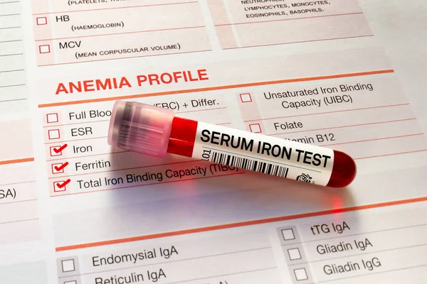 Test Krevní Trubice Rekvizičním Formulářem Pro Test Anémii Krevní Vzorek — Stock fotografie