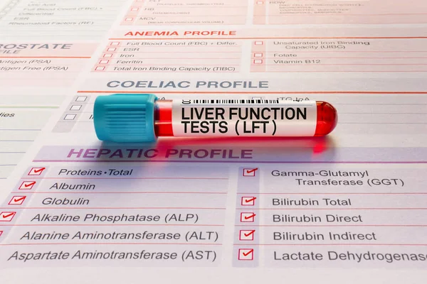 Test Krevní Trubice Rekvizičním Formulářem Pro Testy Jaterních Funkcí Lft — Stock fotografie