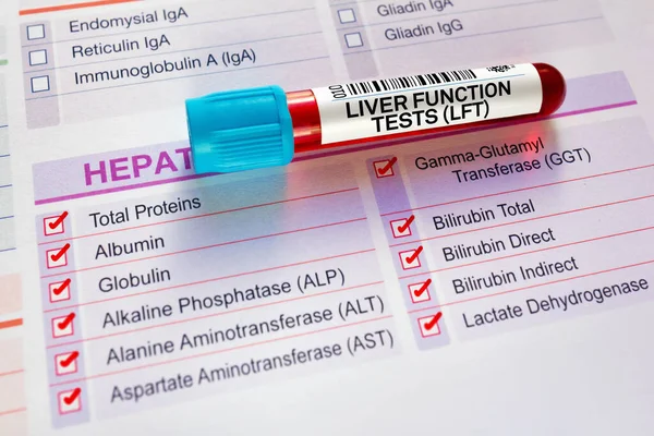 Blutröhrchen Test Mit Anforderungsformular Für Leberfunktionstests Lft Hepatisches Profil Blutprobenröhrchen — Stockfoto