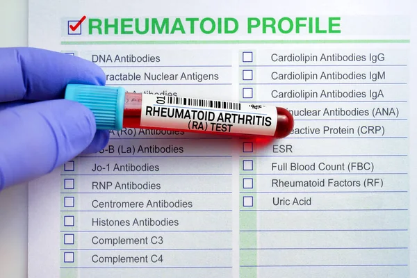 Blood Sample Tube Analysis Rheumatoid Arthritis Profile Test Laboratory Blood — Stock Photo, Image