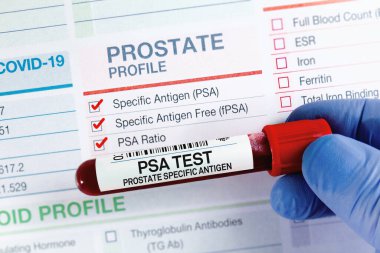 Blood tube test with requisition form for PSA Prostate Specific Antigen test. Blood sample for analysis of PSA Prostate Specific Antigen profile test in laboratory clipart