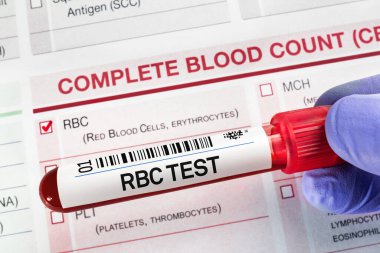 FBC RBC 'nin analizi için kan örneği tüpü laboratuvarda tam kırmızı kan hücresi profil testi. RBC Kırmızı Kan Hücreleri Testi için talep formu içeren kan tüpü testi  