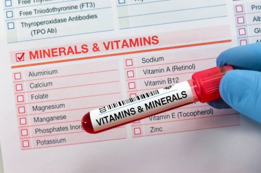 Vitamin ve mineral testi için talep formu içeren kan tüpü testi. Laboratuvarda mineral ve vitamin tahlili için kan örneği tüpü.