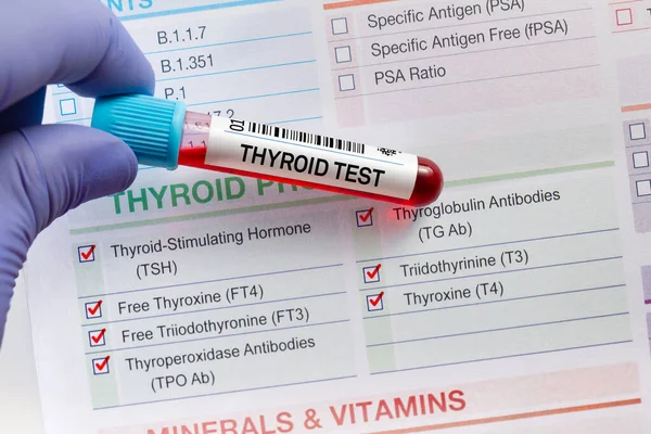 Blood Tube Test Requisition Form Thyroid Gland Test Blood Sample — Stock Photo, Image