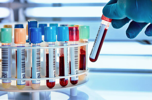 hand of a doctor or nurse holds a blood test tube. technician taking blood tubes in the laboratory centrifuge