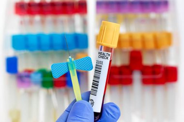 Laboratuvarda temel ve sağlık testleri için hastadan kan örneği alınacak. Genel sağlık kontrolü için kan tüpü ve iğnesi olan doktor.