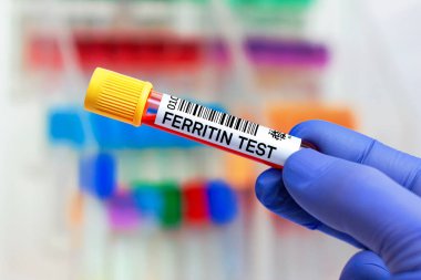 Laboratuvarda Ferritin testi için hastadan kan örneği. Ferritin testi için kan tüplü doktor.