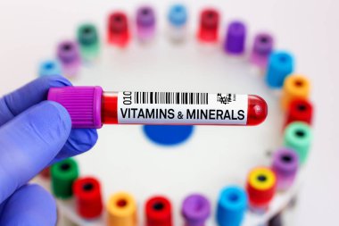 Laboratuvarda vitamin ve mineral testi için hastadan kan örneği. Laboratuvarda vitamin ve mineral testi için kan tüplü doktor