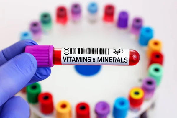 Blood Sample Patient Vitamins Minerals Test Laboratory Doctor Blood Tube — Stock Photo, Image