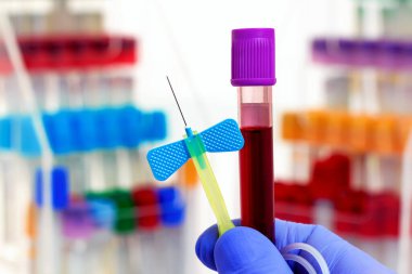 Doktor el, laboratuarda analiz için kan örneği tüpü ve şırınga ile diğer renk tüplerini alıyor. Araştırma laboratuarında kan tüpü testi ve iğne tutan teknisyen.