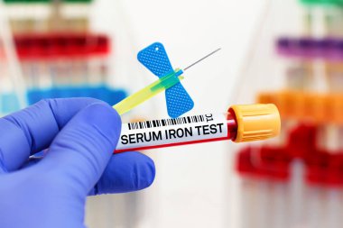 Laboratuvarda Serum Demir testi için hastadan kan örneği. Serum demiri için kan tüpü ve iğnesi olan doktor.