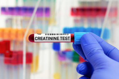 Laboratuvarda kreatinin testi için hastadan kan örneği. Kreatin testi için kan tüplü doktor.