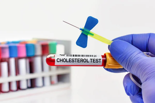 Blodprov Patienten För Kolesteroltest Laboratorium Läkare Med Blodrör För Kolesteroltest — Stockfoto