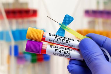 Doktor, ücretsiz triyodotironin FT3 ve bedava tiroksin FT4 hormonlarının analizi için kan tüpünü tutuyor. FT3 serbest triyodotiyoronin ve tiroid muayenesi için FT4 serbest tiroksin için kan örneği