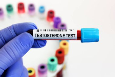 Doktor biyokimya laboratuvarında testosteron analizi için kan tüpü tutuyor. Testosteron hormon testinin seviyelerini incelemek için kan örneği