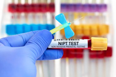 Laboratuvarda Non invazif Doğum Testi için hastadan alınan kan örneği. Antenatal tarama testi için NIPT Non invazif Doğum Öncesi Testi için kateter ve kan tüplü doktor.