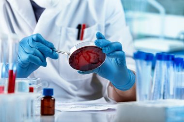 Laboratuvarın mikroskobunda analiz için petri plakası üzerinde çalışan bir bilim adamı. Doktor mikrobiyoloji laboratuvarında petri kabında kültürleri inceliyor ve çalışıyor.