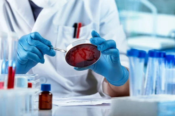 Científico Trabajando Con Placa Petri Para Análisis Microscopio Del Laboratorio — Foto de Stock