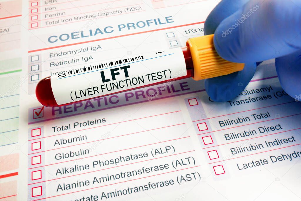 Blood tube test of patient for Hepatic analysis in hematology laboratory. Blood sample over samples requisition form for check of LFT Liver Function Test in laboratory