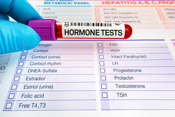 Doktor, biyokimya laboratuvarında hormon analizi için kan tüpü tutuyor. Hormon testlerinin seviyelerini incelemek için kan örneği