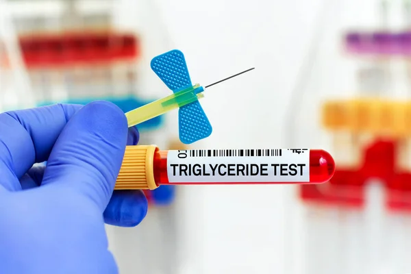 Blodprov Från Patienten För Triglyceridtest Laboratorium Läkare Som Håller Blodrör — Stockfoto