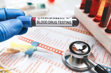 Laboratuvarda kan tüpü analizi için kan örneği tutan bir doktor var. Tıbbi raporlu doktor, steteskop, kelebek iğnesi ve laboratuarda uyuşturucu testi için kan tüpü.