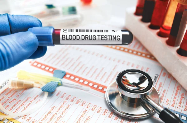 Laboratuvarda kan tüpü analizi için kan örneği tutan bir doktor var. Tıbbi raporlu doktor, steteskop, kelebek iğnesi ve laboratuarda uyuşturucu testi için kan tüpü.