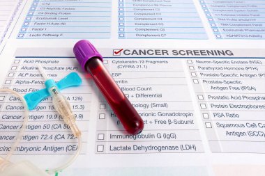 Blood analysis with request form for screening of test for Malignancy oncology cancer cells investigation in patient. Blood test sample for Tumor markers test for diagnosis cancer
