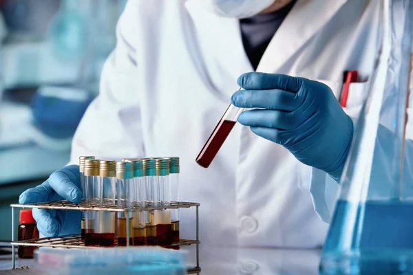 Araştırma Doktoru Laboratuarda Geliştirme Testi Için Hastanın Kan Örneğini Tutuyor — Stok fotoğraf