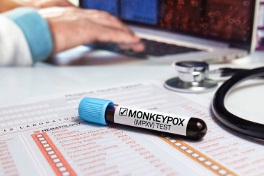 medical office work table with a blood sample from a patient positive for monkey pox virus (MPXV). Doctor's work table with a blood tube diagnosed infection with Monkeypox (MPXV) disease clipart