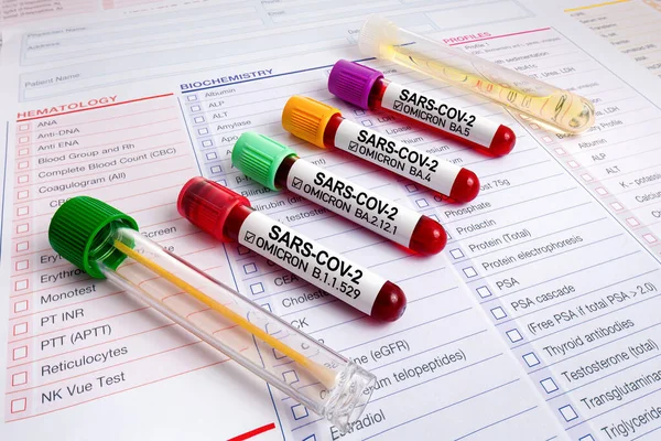 Blood Tubes Medical Request Form Sample Analysis Coronavirus Variants Sars — Stock Photo, Image