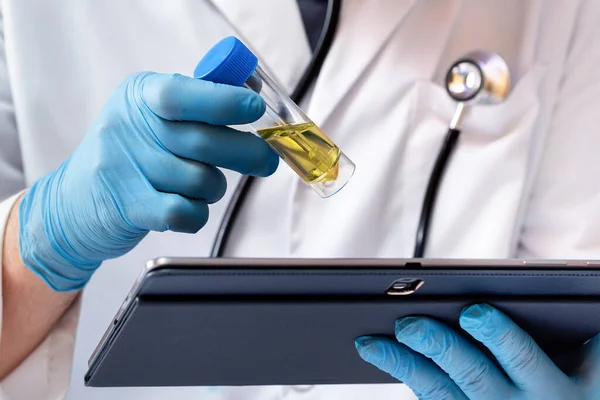 Physician Holding Test Tube Urine Sample Analysis Biochemistry Lab Doctor — Stockfoto