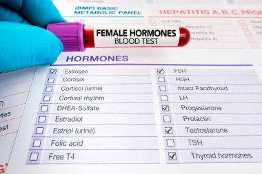 Kadın hormon seviyelerini incelemek için kan testi formunu doldurdum. Doktor, kadın hormon testinin analizi için kan örneği tutuyor.