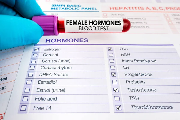 女性のためのホルモンのレベルの研究のための血液検査と要求フォーム 女性ホルモン検査のための血液サンプルを保有する医師 ストック写真