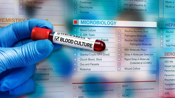 プレート内の文化のための血液管を持つ微生物学者や微生物学研究室のための微生物学的デジタルテストの請願書フォーム 解析および背景微生物学的検査依頼書用の血液サンプルチューブを保持する医師 — ストック写真