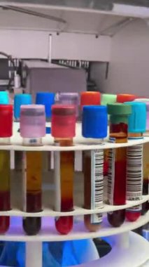 Santrifüj makinesi laboratuvarda analiz için kan örnekleriyle dolu tüpleri santrifüj etti. Doktor, laboratuarda test için plazma ve kan serumlarını ayırmak için santrifüjlenmiş kan örneği içeren bir tüp tutuyor.