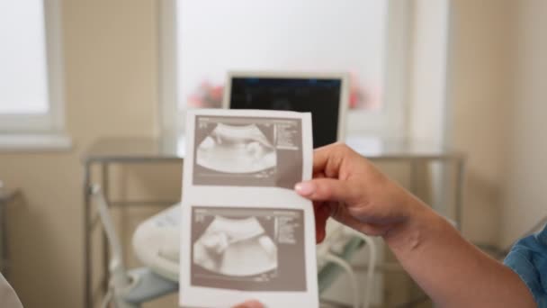 Yakın plan kadın eli, sağlıklı doğmamış bebeğin ultrason görüntüsünü tutuyor. Doktorun eli ve hamile kadının eli kapalıyken doktor, sağlıklı doğmamış bebeğin ultrason görüntüsünü verdi. — Stok video