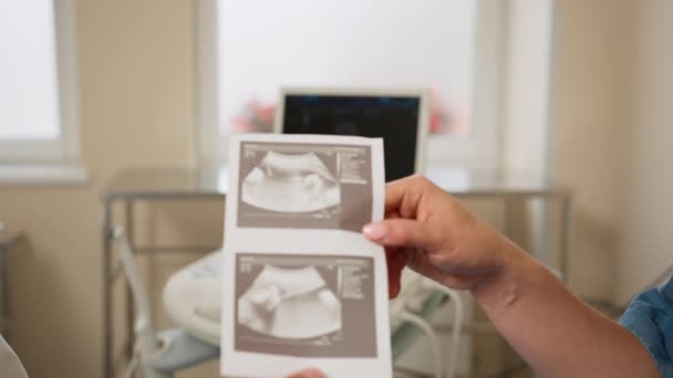 Primer plano de las manos de las mujeres que sostienen la imagen de ecografía del bebé no nacido sano. Primer plano de la mano de los médicos y la mujer embarazada, el médico entrega la imagen de ecografía del bebé nonato sano — Vídeos de Stock