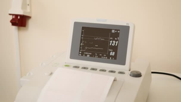Nærbillede af moderne medicinsk udstyr med grafer af føtal hjerte slå. Fosterovervågning af hjerterytmen hos en kvinde og et barn under fødslen, en enhed til overvågning af fosteret – Stock-video