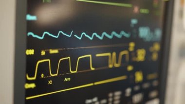 Hastane tiyatrosunda kalp atış hızı monitörü. Anestezi cerrahi monitörüne bağlı bir hastanede tıbbi hayati göstergeler monitörü. EKG. Hasta kalp atışı ekranda. Klinik Odası
