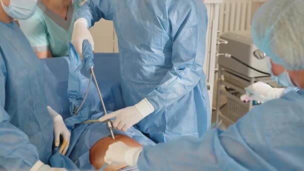 Na sali operacyjnej lekarz robi laparoskopię. Prawdziwa operacja, nacięcie brzucha, praca z chirurgicznymi przyrządami do laparoskopii. Ginekologia. — Wideo stockowe