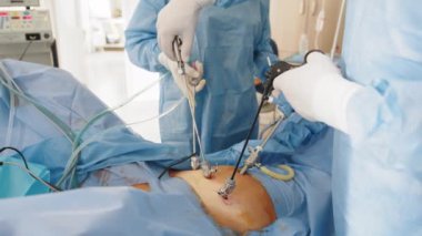 Hastanede laparoskopik ameliyat. Ameliyathanede modern tıbbi ekipman var. Patolojinin tedavisi ya da yok edilmesi için karın boşluğuna cerrahi müdahale, doktorun dikkatli hassas hareketleri