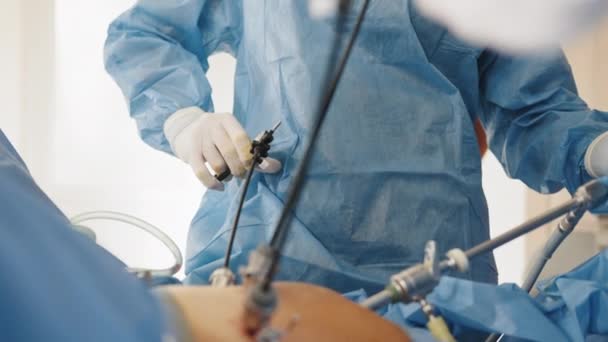 Werking met laparoscopische apparatuur. De chirurgen doen laparoscopische chirurgie in de operatiekamer. Minimaal invasieve chirurgie. Chirurgen team handen tijdens laparoscopische abdominale operatie. — Stockvideo