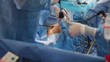 Cerrahlar ameliyathanede laparoskopik ameliyat yapıyorlar. Kanser tümörü alınıyor. Çocuk cerrahisinde laparoskopik karın ameliyatı sırasında cerrahlar el ele verir. Laparoskopik ameliyat için araçlar.