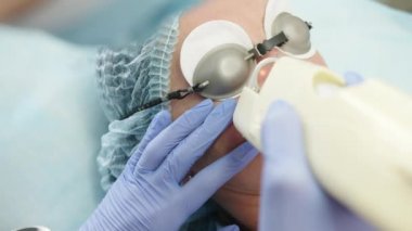 Lazer darbeleri deriyi temizler. Donanım kozmetolojisi. Cilt bakımı kliniğinde lazer tedavisi gören bir kadın. Yüzündeki kırışıklıklar, yaralar ve güneş hasarları için yeniden yüzeye çıkma tekniği..