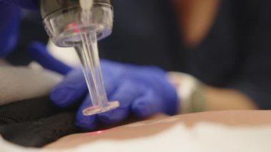 Lazer estetik cerrahi ve cilt dermatolojisinde yeniden yüzeye çıkıyor. Güzellik lazeri teknisyeni tıbbi bir kaplıca ve güzellik kliniğinde cilt yenileme prosedürü uyguluyor. Lazer darbeleri deriyi temizler..