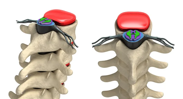 Human spine in details: Vertebra, bone marrow, disc and nerves — Stock Image Human spine in details: Vertebra, bone marrow, disc and nerves Royalty Free Stock Images