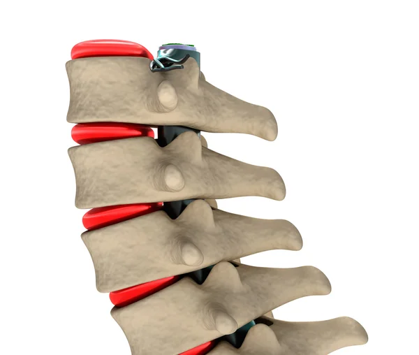 Human Spine, 3D illustration — Stock Image Human Spine, 3D illustration Stock Photo
