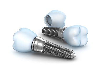 Dental implants , crown with pin isolated on white clipart